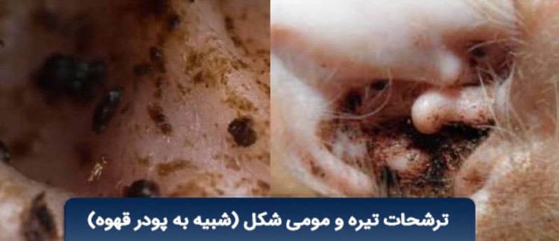 ترشحات تیره رنگ و مومی داخل لاله گوش (شبیه پودر قهوه)