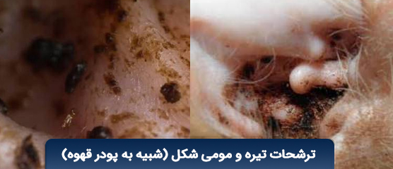ترشحات تیره رنگ و مومی داخل لاله گوش (شبیه پودر قهوه)