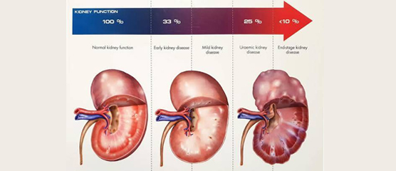 بیماری کلیوی در گربه ها Chronic Kidney Disease | بیماری های رایج گربه